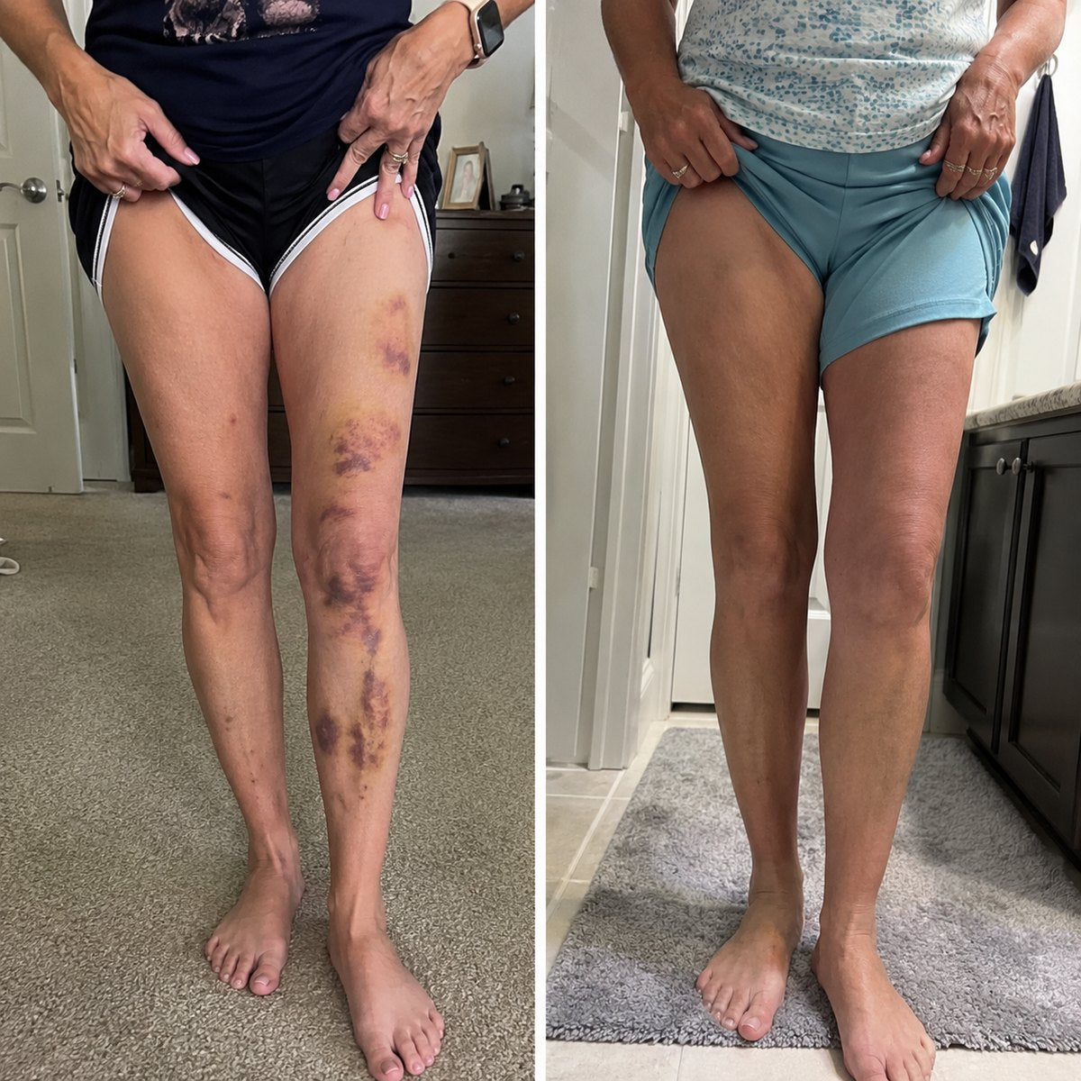 Kakiya Collagen Gummies before and after