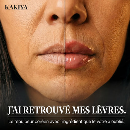 J'ai retrouvé mes lèvres — avant / après