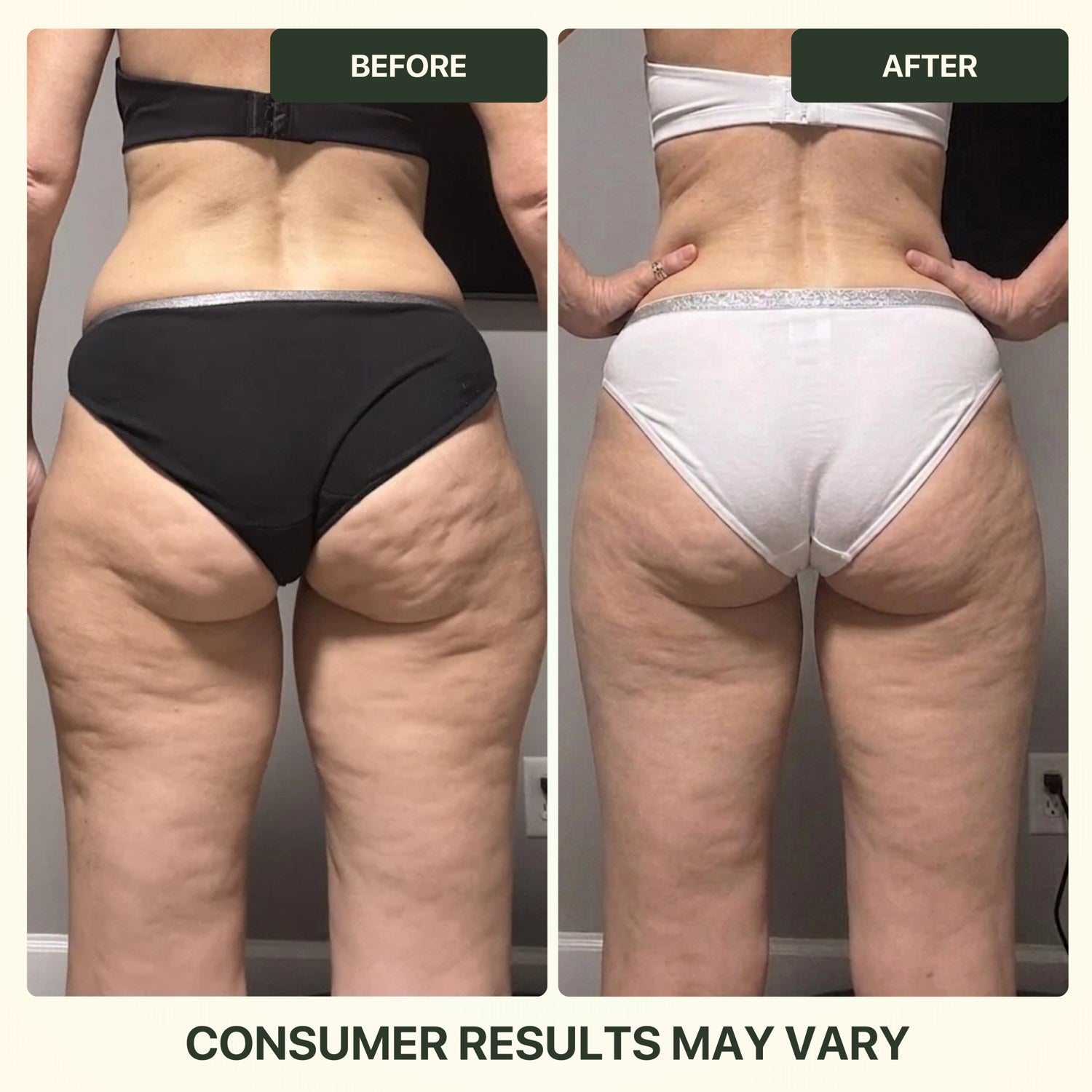 It visibly firms and smooths the look of belly skin.