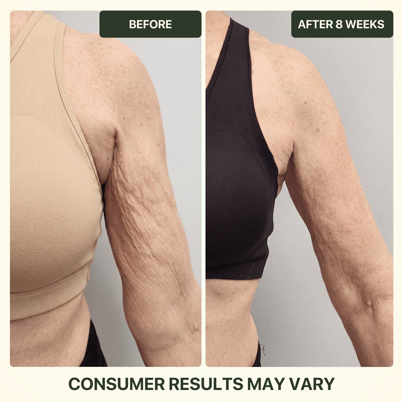 It visibly firms and smooths the look of crepey skin